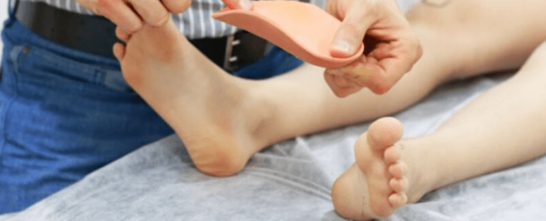 Flat Foot Treatment in Singapore