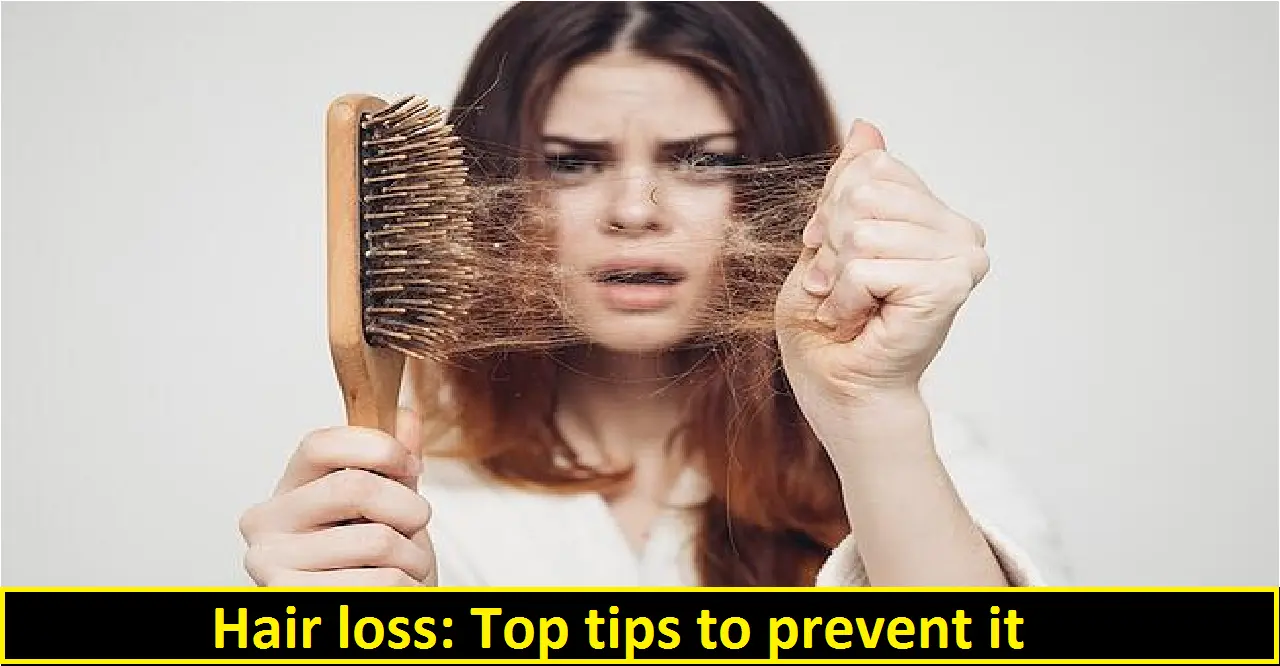 Hair loss- Top tips to prevent it